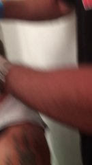 Boxer Doctor makes jokes with open Wound on Man's Head
