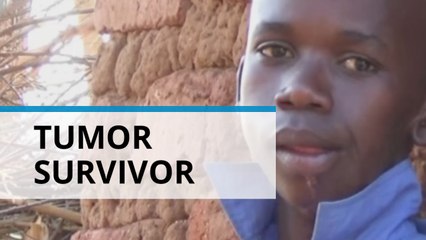 Happy outcome: Boy with rare mouth growth has surgery