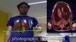 mirracle: An Augmented Reality Magic Mirror System for Anatomy Education