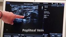 Doppler Ultrasound Imaging for Detection of Deep Vein Thrombosis in Plastic Surgery Outpatients