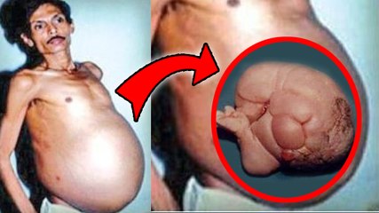 Shocking! Pregnant MAN Gave BIRTH To His BROTHER