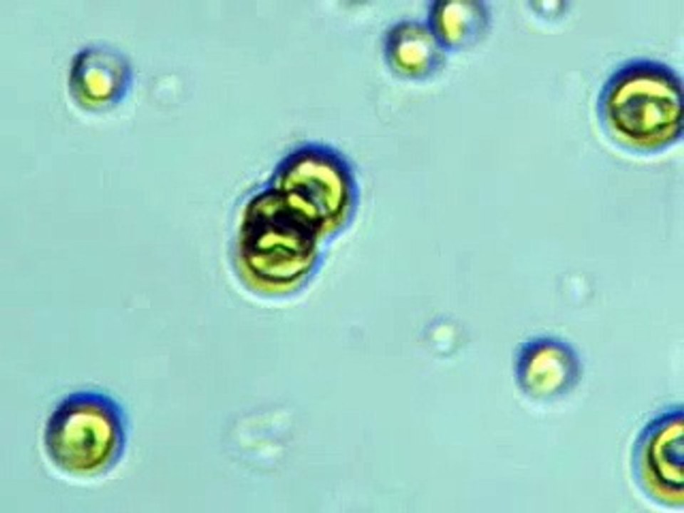 Chlorella vulgaris under microscope