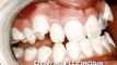 Professional Perspectives on Water Fluoridation - Part 2 of 3