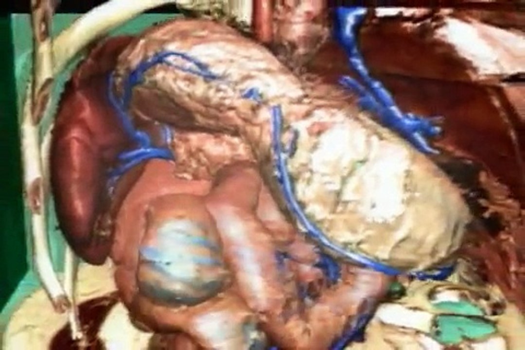 Discovery Channel - Viagem pelo corpo Humano 5/5 [Final]