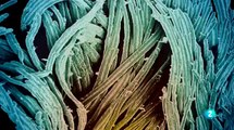 Granos de polen al microscopio electrónico.