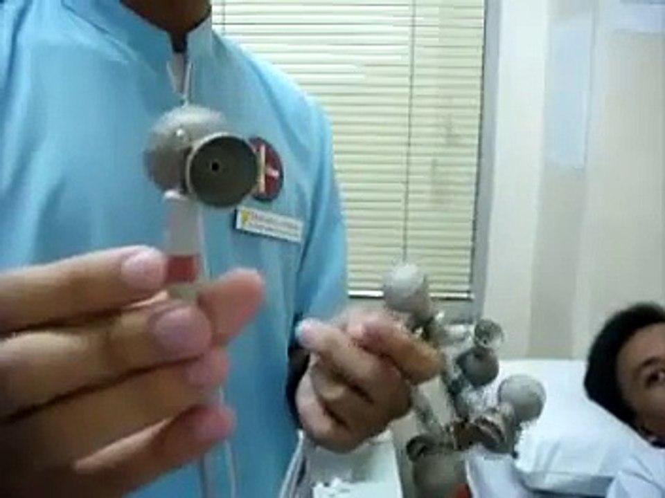 ECG
