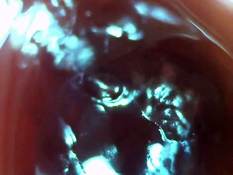 ~ MORGELLONS ~ strange movement worm?