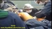 VIDEO DE LA OPERACION DEL TIGRE RADAMEL FALCAO GARCIA | radamel falcao lesion