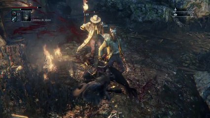 Bloodborne™intento para cruzar el bosque prohibido 1