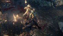 Bloodborne™intento para cruzar el bosque prohibido 1