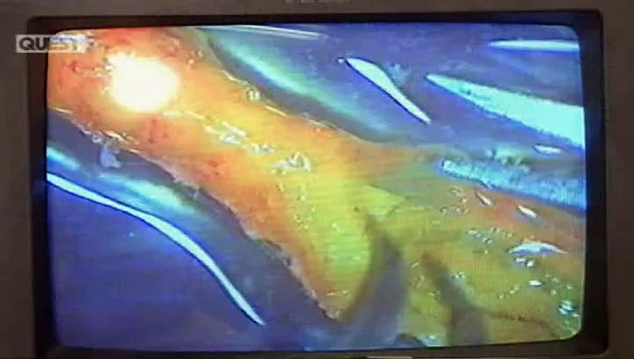 Total Fishing - S01E28