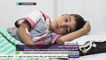 ٤٠٠ ألف مدني في الغوطة الشرقية يعانون أوضاعا صحية وطبية سيئة بسبب الحصار