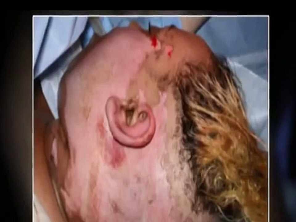 Amazing Tattoo Artist Uses Ink To Cover Burn Victims Scars!