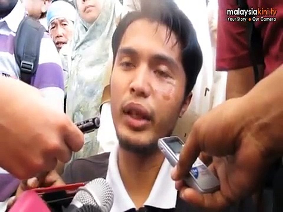 Lawyer: Cops denied assault before proper probe