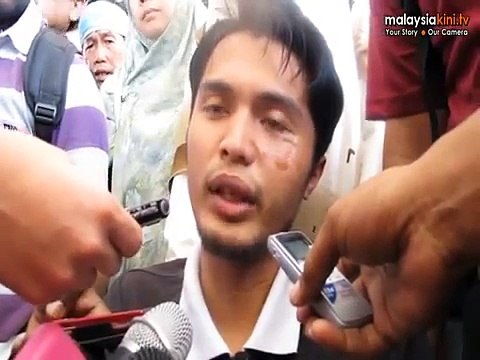 Lawyer: Cops denied assault before proper probe