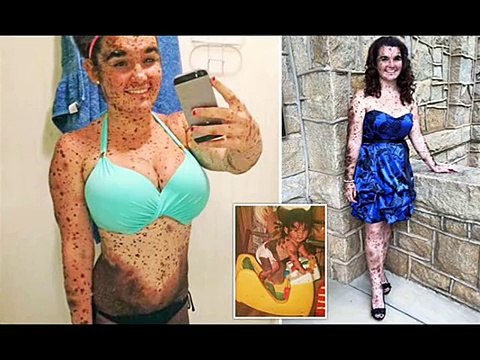 Ciera Swaringen insultée par ses camarades de classe à cause de sa peau