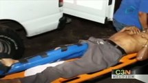 Hombre pierde su pierna tras ataque de cocodrilo