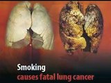 El tabaco y sus consecuencias