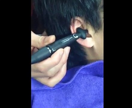 DIY Ear Cleaning (14) Ear Cleaning Relaxation and Stress Relief