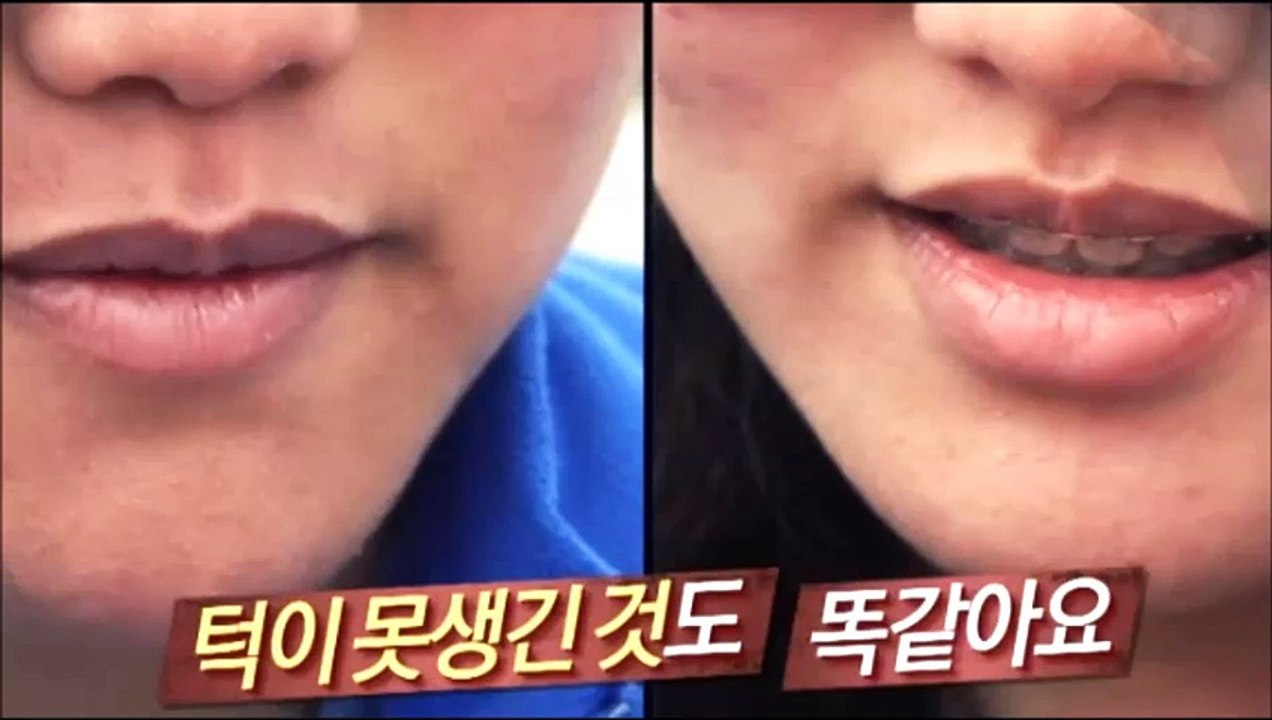 렛미인 시즌5  12회 쌍둥이자매 150821 FULL HDTV 렛미인 시즌5  12...