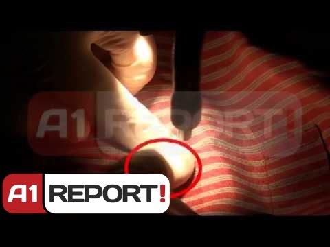 21 Janari, ekspertiza e Çardakut Tv A1 REPORT publikon videon