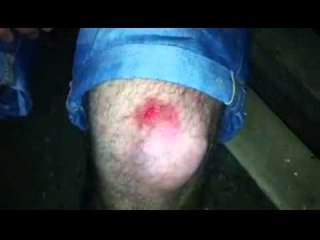 Incident në Shkup, sulmohen dy të rinj shqiptarë