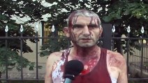 Dhunohet komisioneri i PS në Kukës, policia: S'ka arsye politike, motive të dobëta