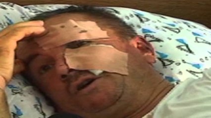 Peqin, hyjnë të vjedhin banesën, plagosin çiftin e bashkëshortëve