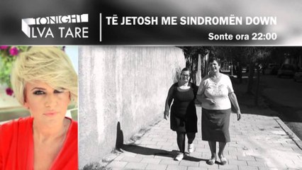 Te jetosh me sindromen Down