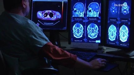 Longer work weeks increase risk of stroke, according to study