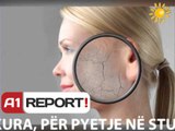 A1 Report - Rreze Dielli dt 03 Mars 2014 Mjeku per ju Dr,Vjoleta Dajci, Dermatologe