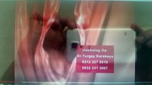 Kızlık Zarı Dikimi Fiyatı Jin Op Dr Turgay Karakaya