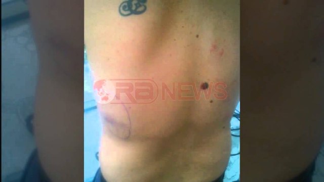 Polici i Korçës merr peng dhe dhunon borxhliun e të vëllait. I kishte marrë 8 mijë lekë