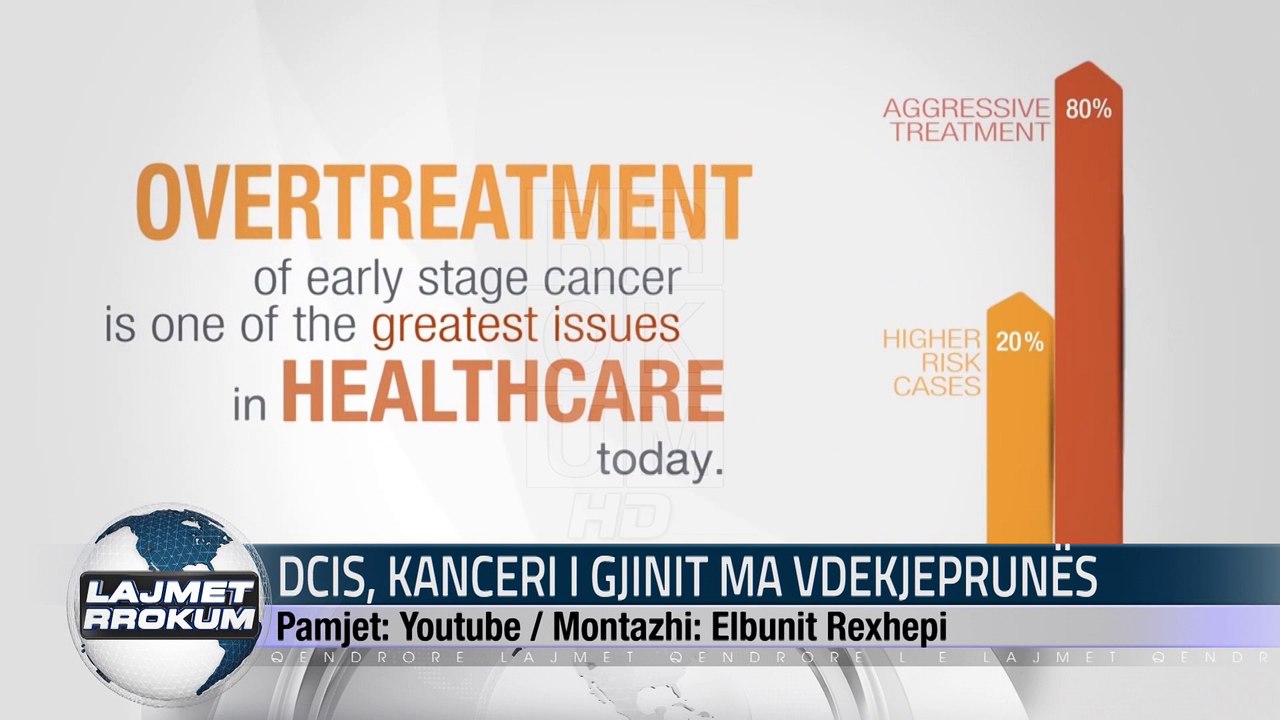 DCIS, KANCERI I GJINIT MA VDEKJEPRUNES