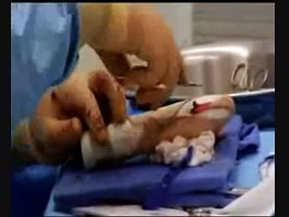 Sex Change Video