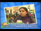 Evitar el acne, prevenir el acne, cuidados y recomendaciones - Entrevista en Global Tv Perú