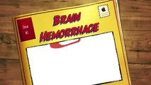 Brain Hemorrhage - hemorrhagic stroke