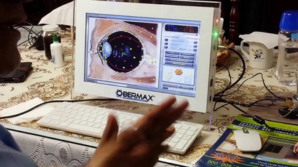 Obermax - 'Biorresonancia - Sistema de analisis no linear' en el globo ocular