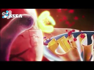 Orvosok velemenye az ASEA-rol magyarul