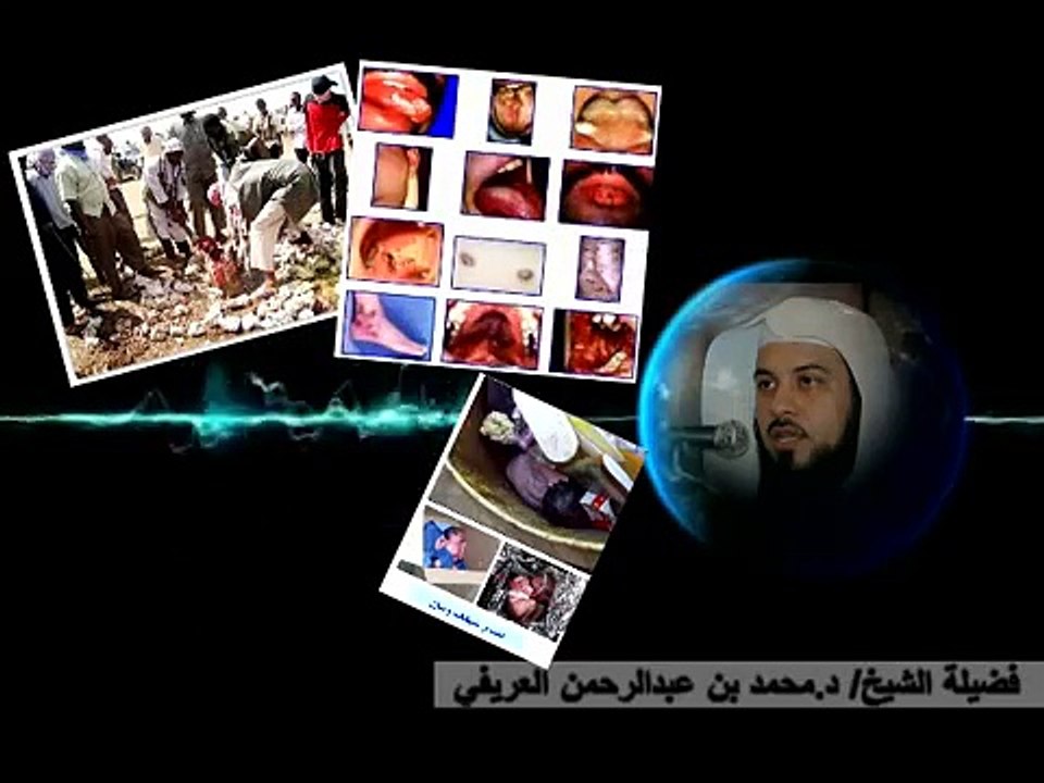 عقوبة الزنا في الدنيا والآخرة : العريفي + اللحيدان
