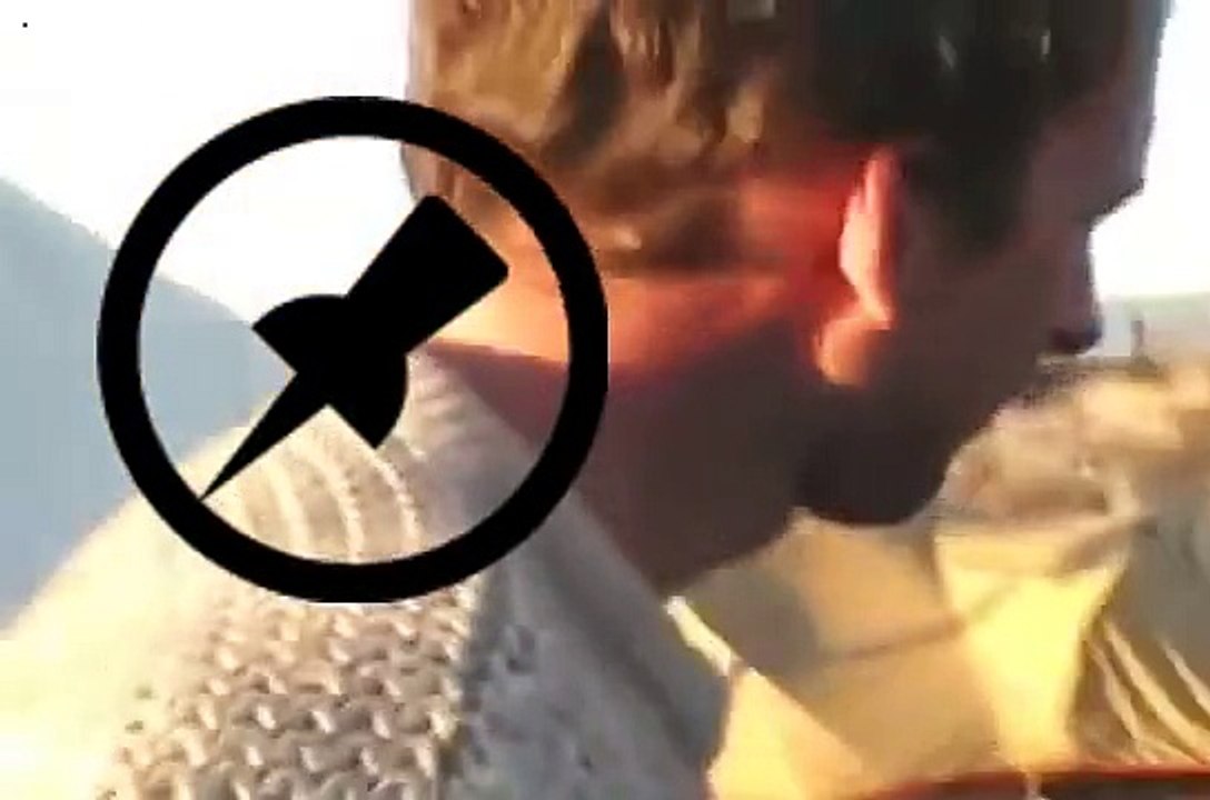 Huge Botfly Maggot Removed from humans skin - botfly extraction parasite1