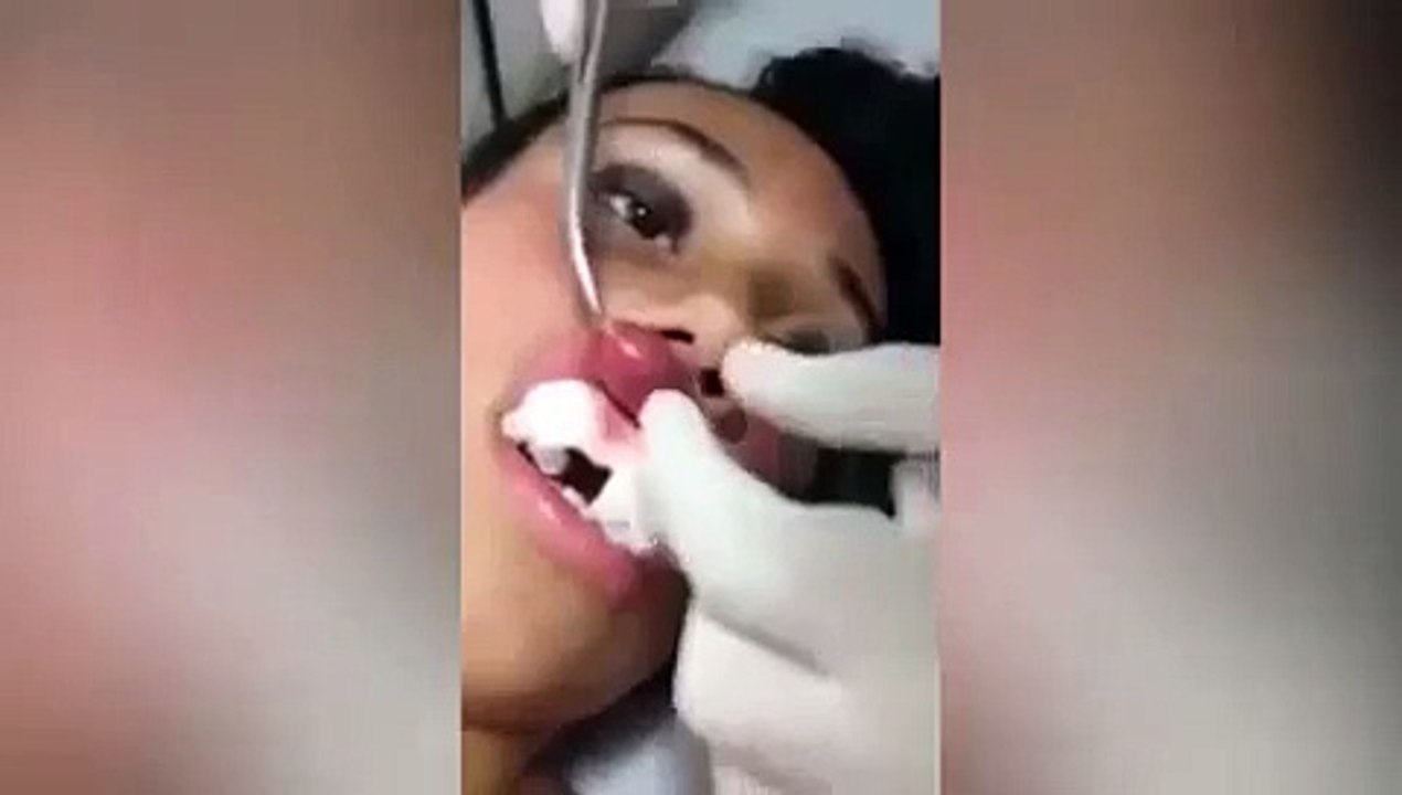 Gruesome Video Shows Doctor Removing A LIVE MAGGOT From A Woman's Lip
