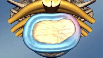 Quiropraxia Gonstead