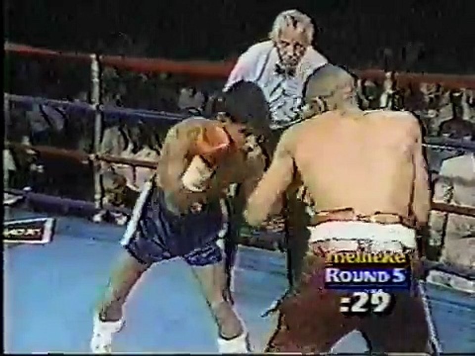 Pedro Feliciano vs Louis Curtis (Worst Boxing Hematoma ever?) video