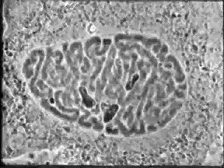 mitose cellule végétale           انقسام الخيطي المتساوي خلية نباتية