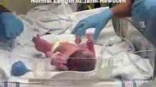 Assessment of the Newborn: The Head-to-Toe Assessment