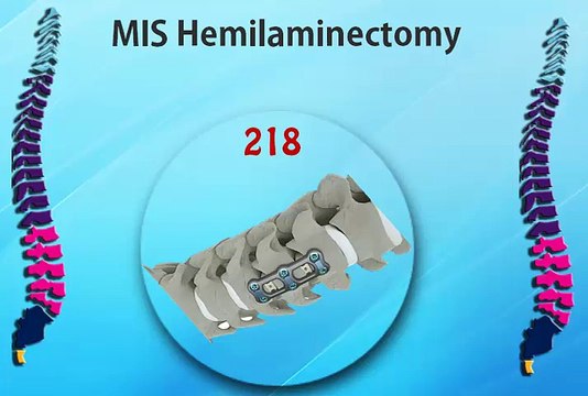 Excellence Through Evidence - Minimally Invasive Spine Centers Of Excellence