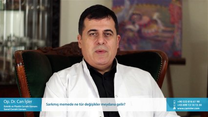 Sarkmış memede ne tür değişikler meydana gelir? - Op. Dr. Can İşler