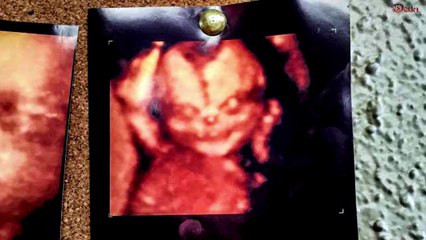 Increíble Bebe Demonio Es Captado En Ecografía 4d