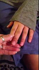 Hair,nails, and skin assessment